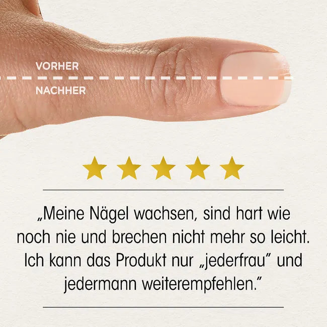 Dr. Böhm Skin, Hair & Nails | Silica, Golden Millet Extract, Biotin, MSM, Zinc & Selenium | Beauty Support Formula | 180 Tablets | PZN 19485477