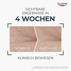 Eucerin Hyaluron-Filler + Longevity Epigenetic Day SPF 30 50ml | Anti-Aging Day Cream with Epicelline | PZN 20352474